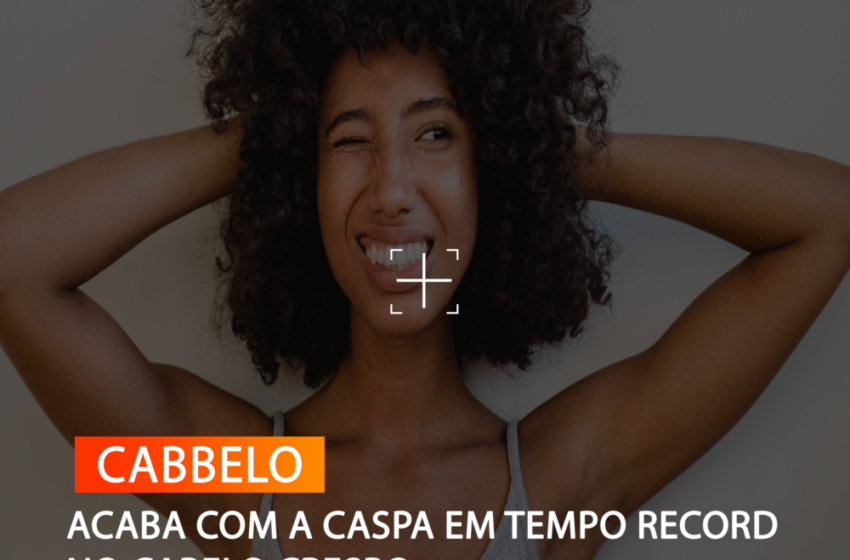  ACABA COM A CASPA EM TEMPO RECORD NO CABELO CRESPO